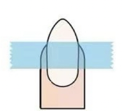 An instructional image showing the first two steps for measuring nails: Step 1, placing transparent tape over the nail, and Step 2, pressing down on the sides to create a crease for an accurate size measurement.